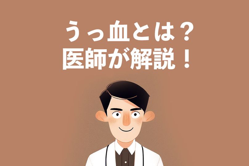 うっ血とは？血流が滞る原因、症状を徹底解説